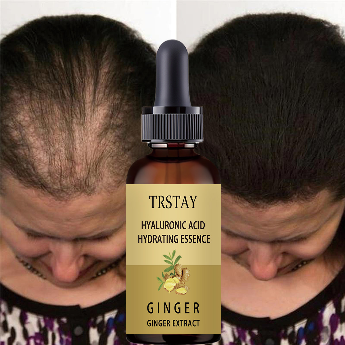 Caffeine Hair Serum - Sérum de croissance des cheveux, Anti-chute,