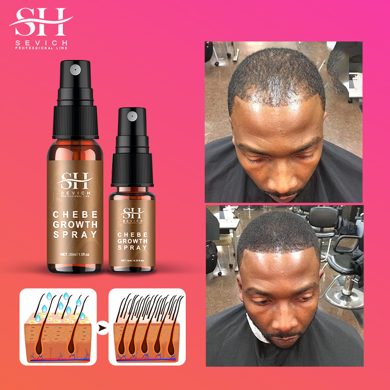 Caffeine Hair Serum - Huile de pulvérisation de Chebe africaine,