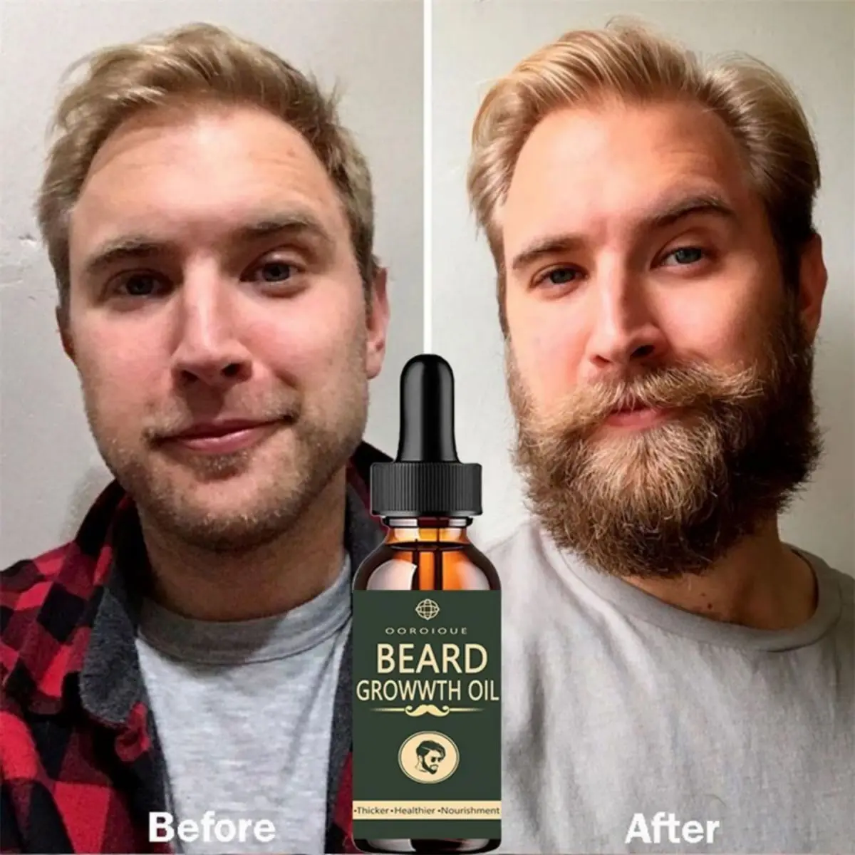 Caffeine Hair Serum - Huile de croissance rapide de la