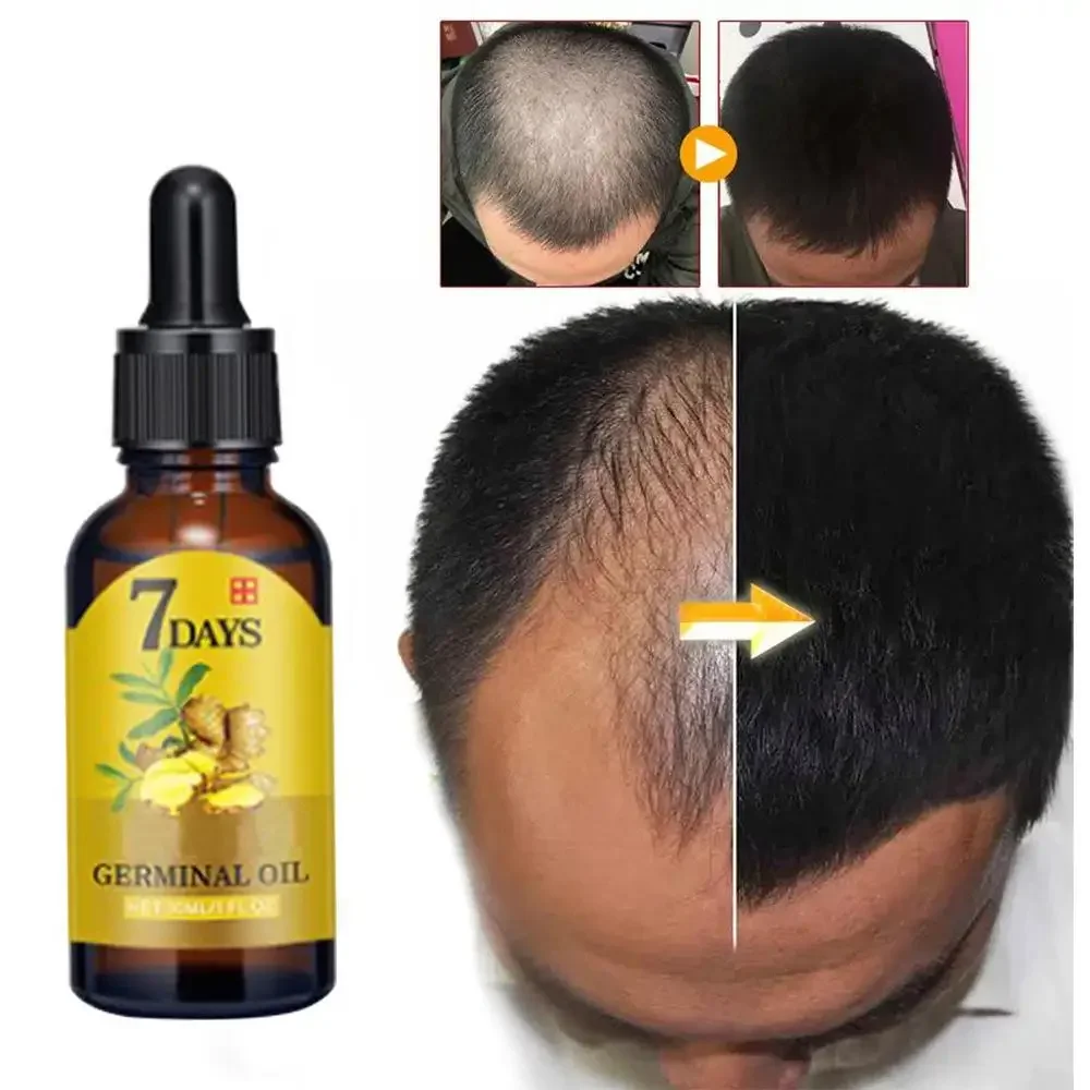 Caffeine Hair Serum - Huile essentielle de gingembre pour la