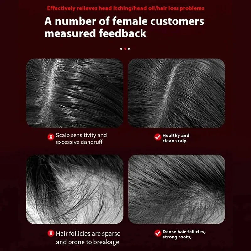 Peigne de massage vibrant élec - Hair Care For Hair Loss avis et prix