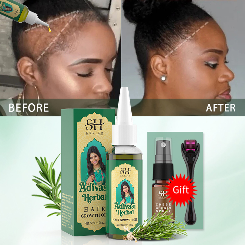 Huile de croissance capillaire - Caffeine Hair Serum avis et prix