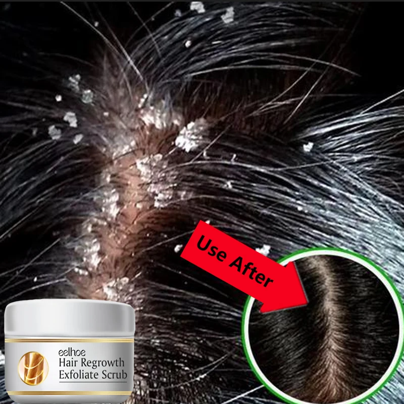 Traitement Capillaire Antichut - Scalp Scrub Exfoliant avis et prix
