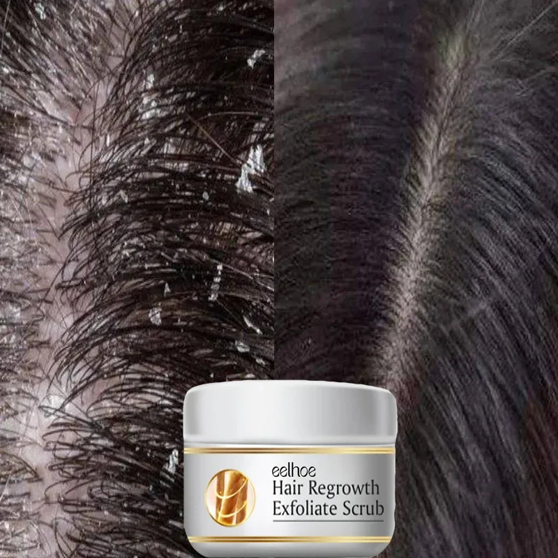 Traitement Capillaire Antichut - Scalp Scrub Exfoliant avis et prix
