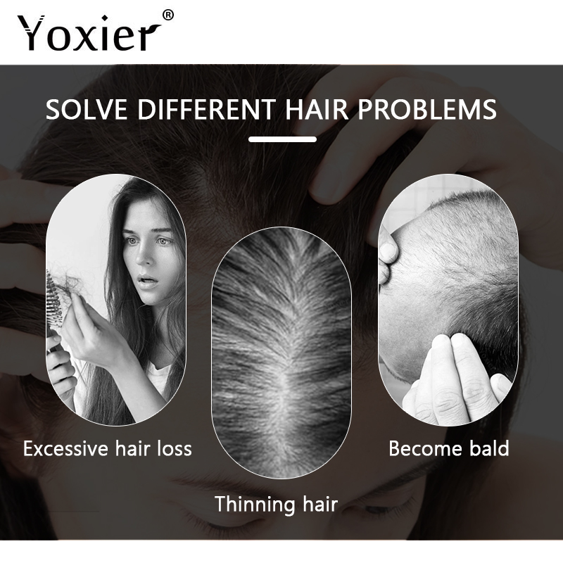 Sérum à croissance Intensive p - Hair Care For Hair Loss avis et prix