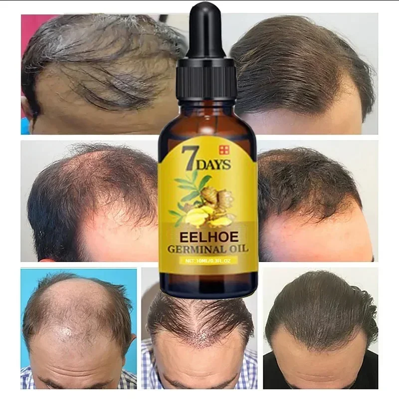 Huile de croissance rapide des - Caffeine Hair Serum avis et prix