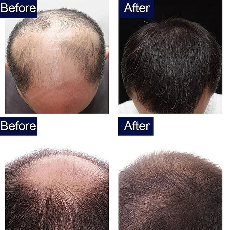 Huile de croissance rapide des - Caffeine Hair Serum avis et prix