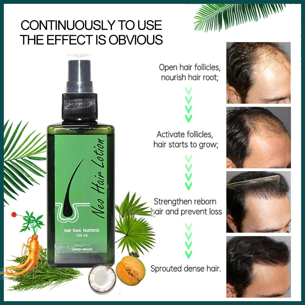 Original Neo Lotion capillaire - Hair Care Thailand avis et prix