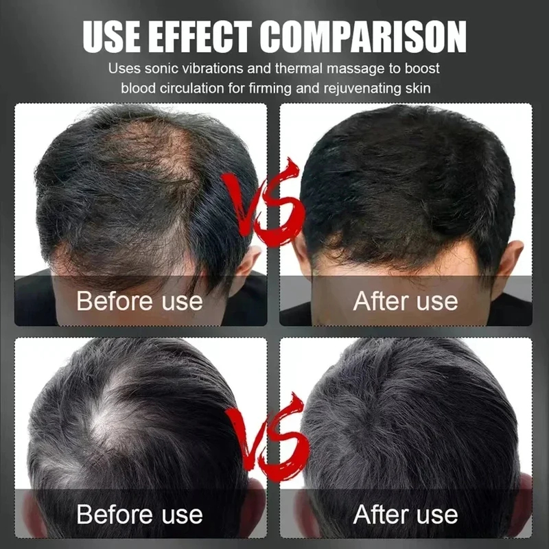Casque de thérapie capillaire  - Hair Care For Hair Loss avis et prix